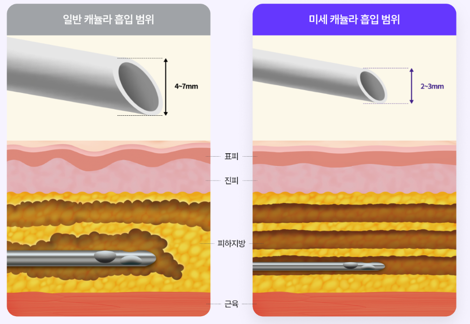 The Secret to Improving the Face and Neckline at the Same Time, Explained Through V-Neck Lifting and Recommended by a Sinsa Station Plastic Surgery Clinic image 13