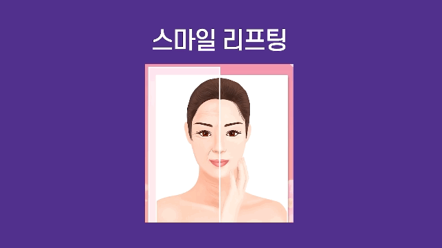 팔자주름 개선 얼굴주름리프팅으로 시술 비용 줄이기 관련 이미지 9