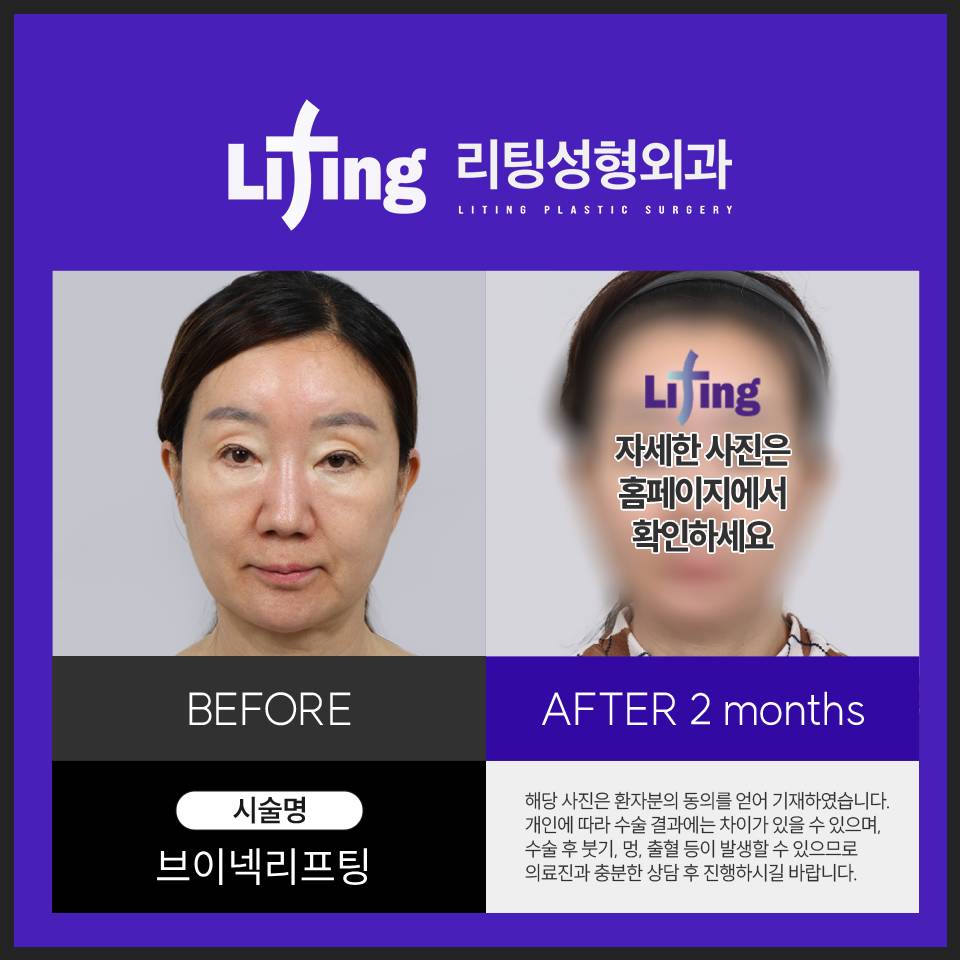 목거상술비용만 확인하면 안 되는 이유 관련 이미지 5