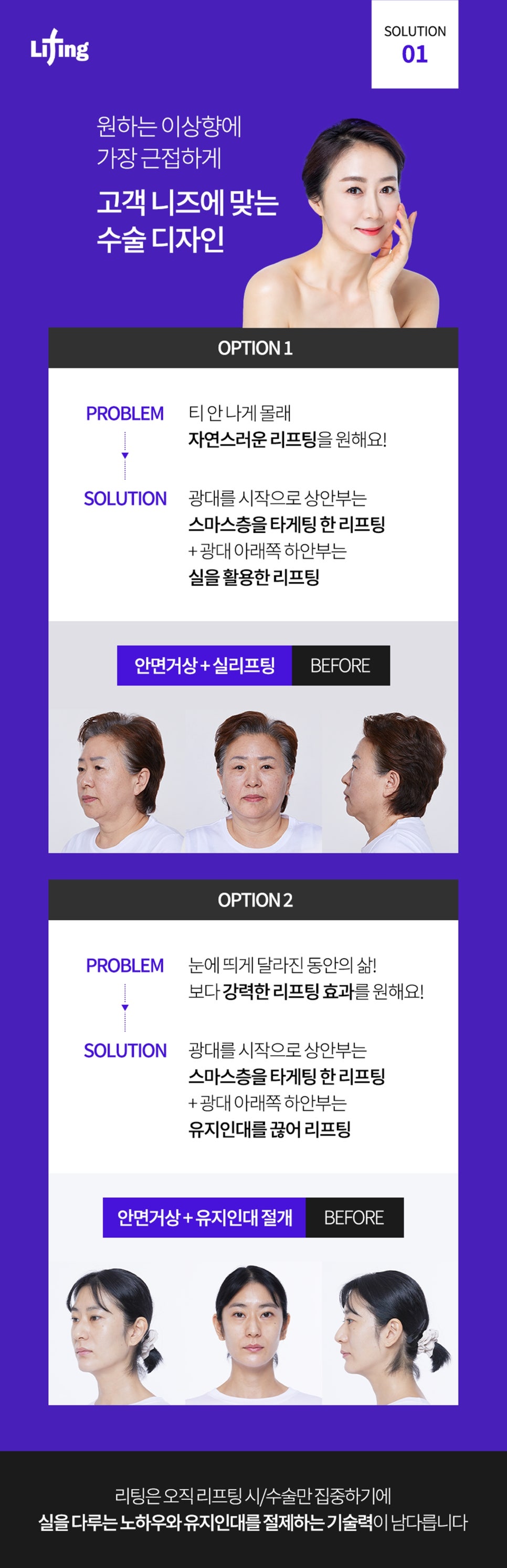 Seoul Gangnam Plastic Surgery: The Lifting Approach Explained by a Facelift Surgeon image 5