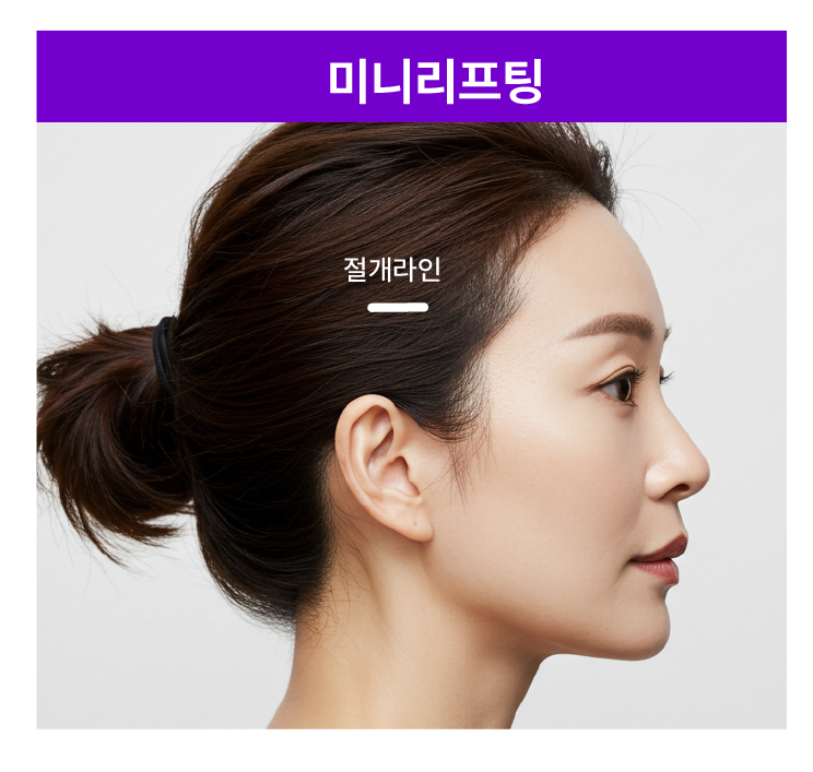스마일리프팅가격 궁금하다면? 스마일거상과의 차이까지 한번에 정리 관련 이미지 4