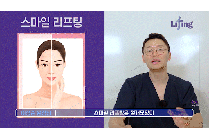 Mini Facelift, Gangnam Facelift: 3 Features That Create a Youthful Effect image 10