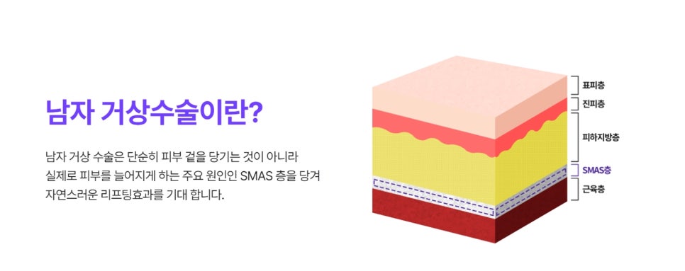 남자안면거상? 첫 시도에 성공하려면 <필독> 관련 이미지 3