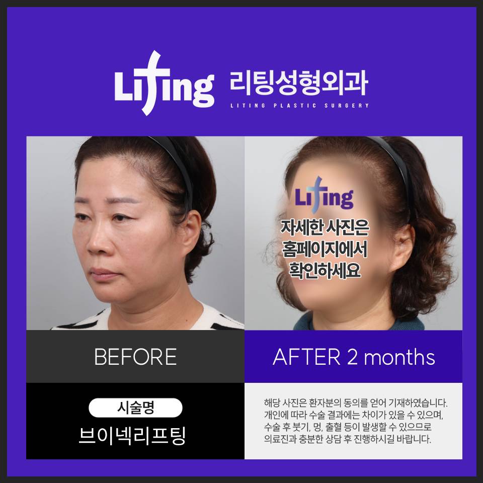목거상술비용만 확인하면 안 되는 이유 관련 이미지 7