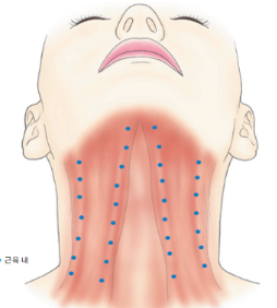 A Story That People Worried About Facelift Scars in Sinsa Station Plastic Surgery Should Definitely Read image 10