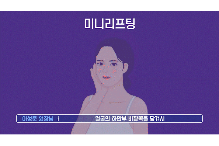 Smile Lift: The Effects and Differences Compared with Mini Lifting, as Seen at a Songpa Plastic Surgery Clinic image 4