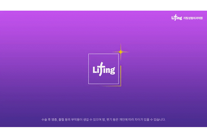 스마일미니리프팅, 압구정리프팅성형외과가 알려주는 인기많은 리프팅 최신 트렌드 관련 이미지 1