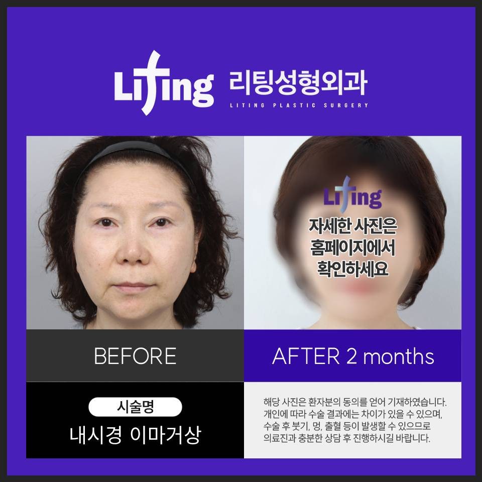 내시경 이마거상술 가격을 알아보고 계신다면 주목하세요! 관련 이미지 6