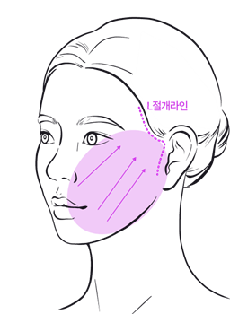 Subtle, Natural Beauty with Facial Wrinkle Lifting at Sinsa Station Leting Plastic Surgery image 5