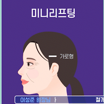 처진볼살리프팅후기에서 시작된 고민, 미니리프팅가격보다 중요한건 ‘방향’입니다 관련 이미지 8