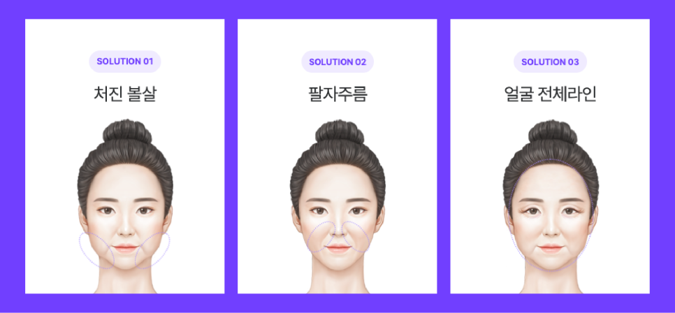 강남미니거상, 왜 안면거상성형외과에서도 주목할까? 관련 이미지 5