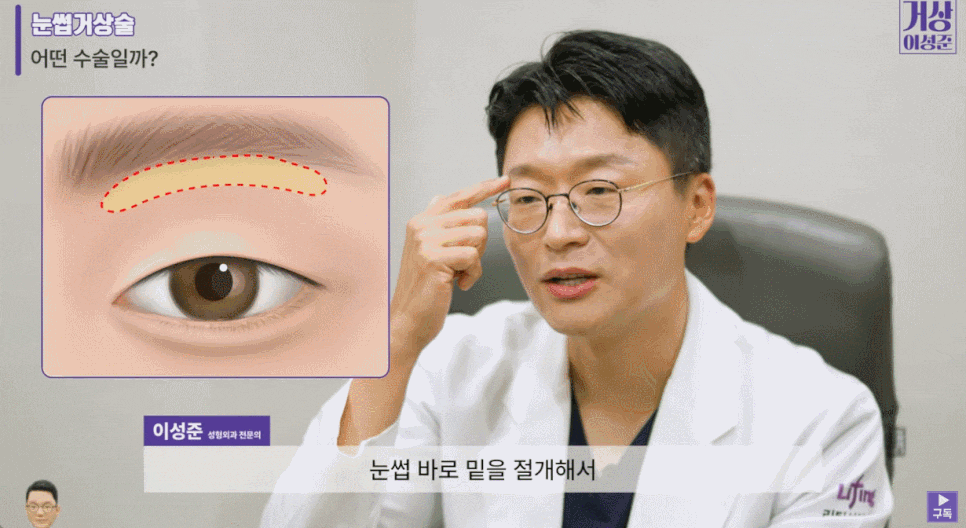 이마눈썹거상술? 관련 이미지 4