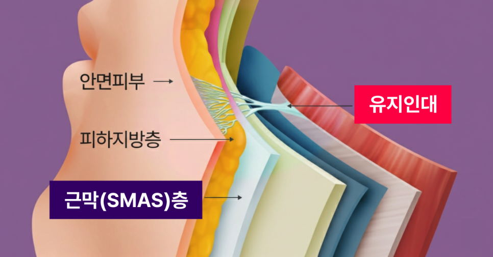 하안부는 왜 먼저 무너질까 청담미니리프팅과 브이라인리프팅의 구조적 접근 관련 이미지 4