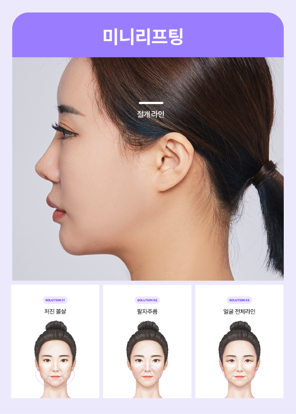 Sinsa Facial Rejuvenation, Gangnam Lifting Plastic Surgery Clinic: Natural Custom Trend Lifting image 8
