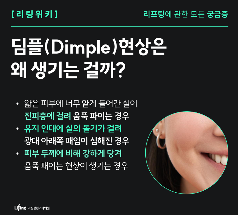 Facial Sagging Lift: Where to Start? Step-by-Step Elasticity Care Beginning with Apgujeong Thread Lifting image 17