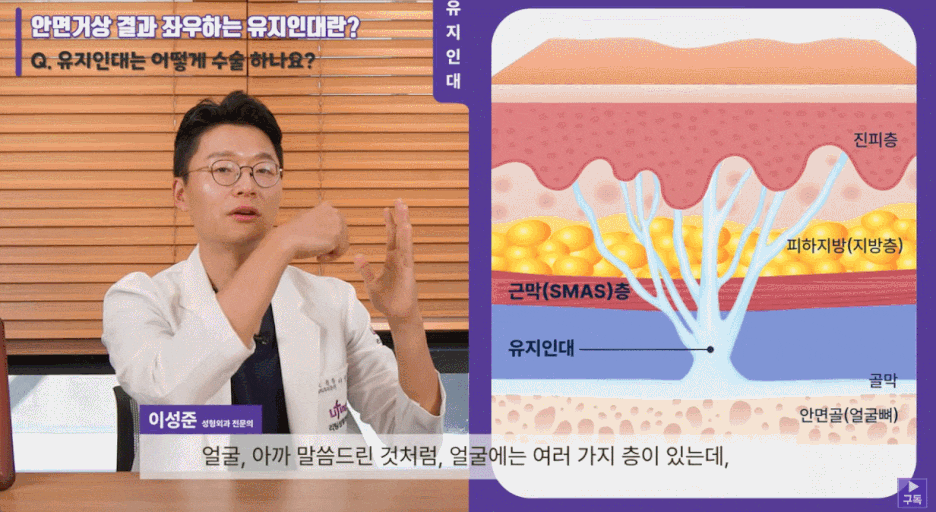 Learn the Criteria for Choosing Facelift Surgery in Gangnam image 6