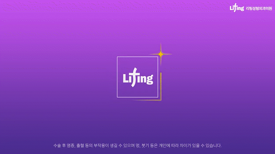 스마일리프팅가격 궁금하다면? 스마일거상과의 차이까지 한번에 정리 관련 이미지 1