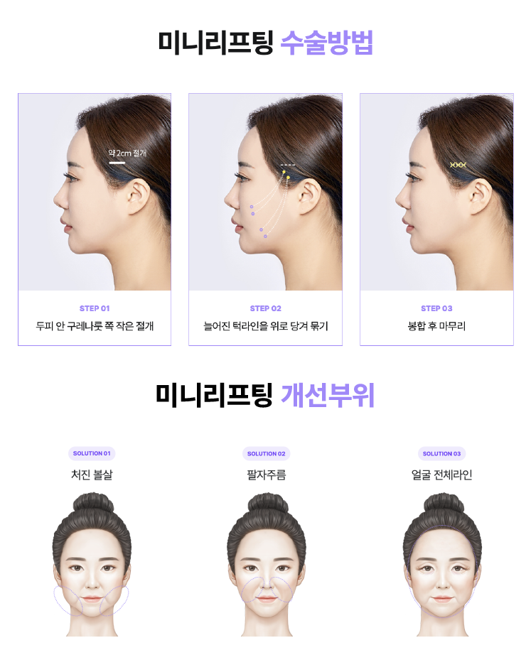 스마일미니리프팅, 압구정리프팅성형외과가 알려주는 인기많은 리프팅 최신 트렌드 관련 이미지 8
