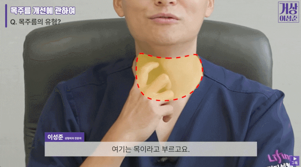 What If Botox for Vertical Neck Wrinkles Didn’t Help? image 4
