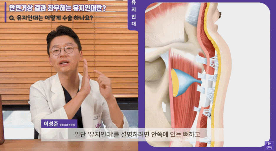 Learn the Criteria for Choosing Facelift Surgery in Gangnam image 5