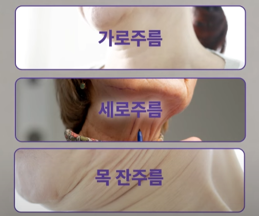 If you’re 고민ed about neck wrinkle procedures or neck wrinkle surgery, start with the wrinkle type at 리팅성형외과 image 4