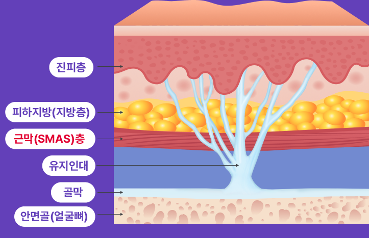 하안부는 왜 먼저 무너질까 청담미니리프팅과 브이라인리프팅의 구조적 접근 관련 이미지 17