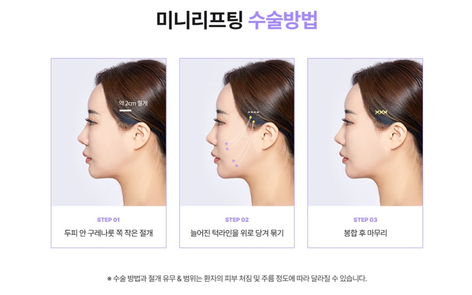 미니거상잘하는곳, 이름이 알려진 이유는 바로 이것입니다 관련 이미지 5