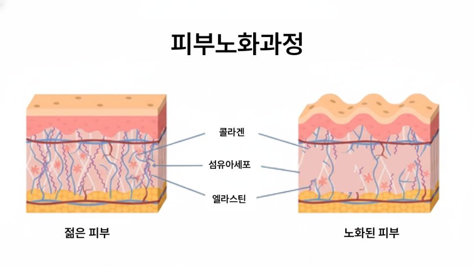 Facial Sagging Lift: Where to Start? Step-by-Step Elasticity Care Beginning with Apgujeong Thread Lifting image 4