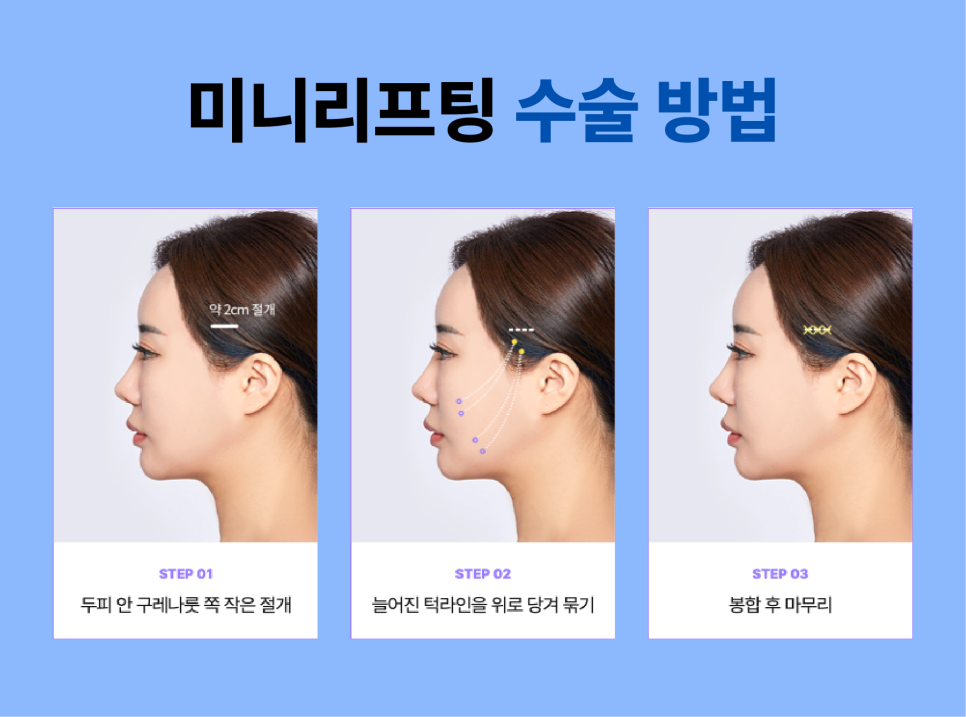 The Difference in Price Between Seoul Facelift and Mini Lifting: How to Choose a Lifting Procedure Wisely in Summer image 4