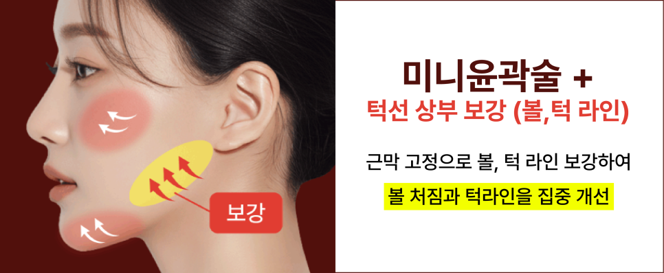 안면윤곽수술 뼈를 깎지 않고 윤곽선을 다듬는 신사윤곽성형외과 관련 이미지 15