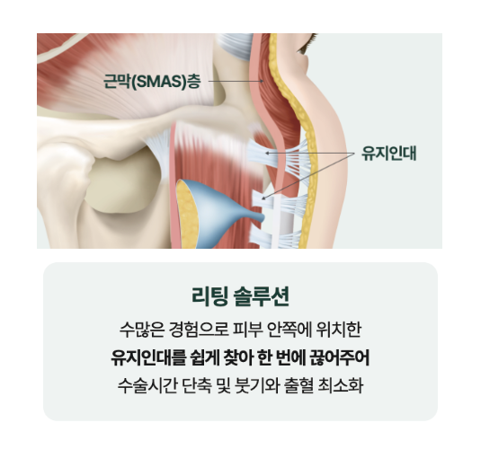 신사역리팅 안면거상술가격 차이, 비용보다 매우 중요한 건 ‘이것?’ 관련 이미지 12