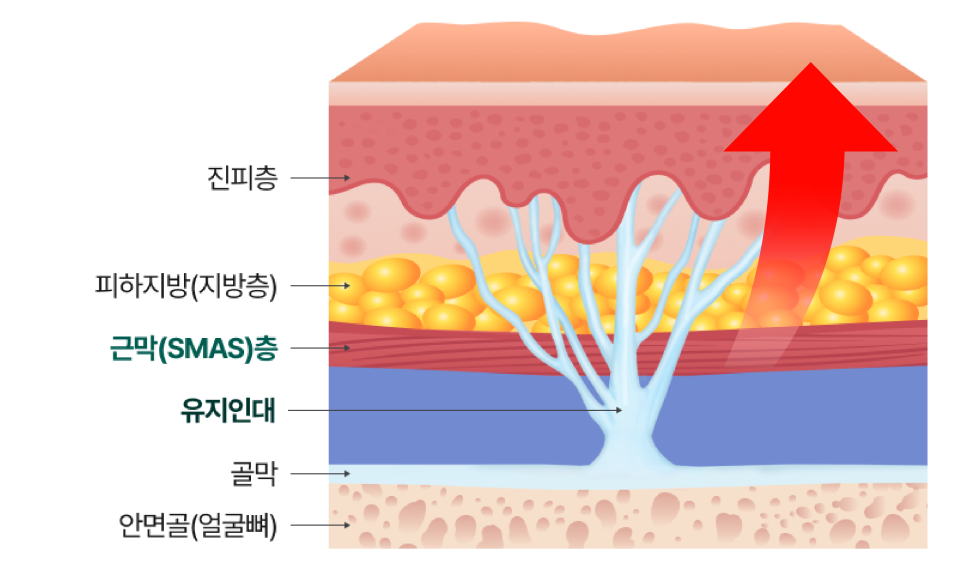 Gangnam Facelift vs. Sinsa Station Lifting: Why Is the Difference in Results So Big? image 4