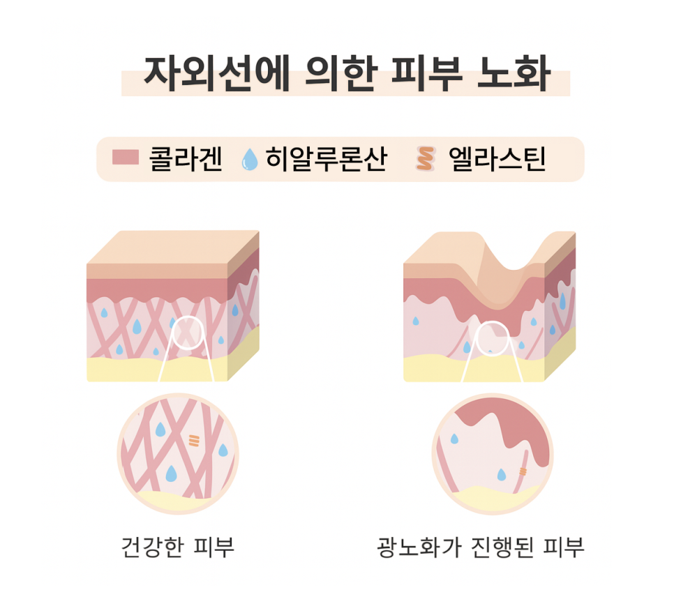 턱살리프팅, 강남역성형외과 여름다이어트 얼굴선 관리하는 법 관련 이미지 4