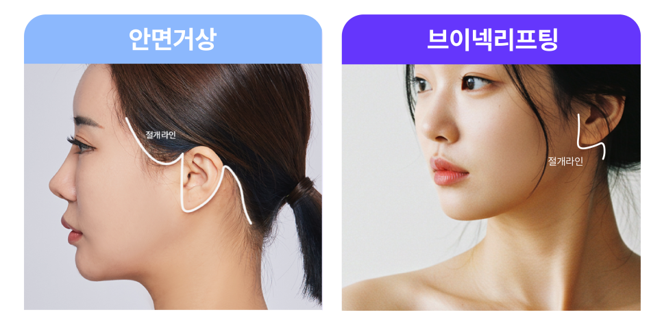 The Secret to Improving the Face and Neckline at the Same Time, Explained Through V-Neck Lifting and Recommended by a Sinsa Station Plastic Surgery Clinic image 5