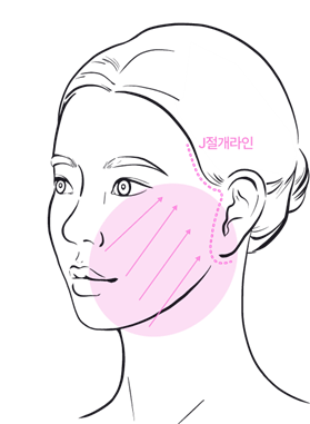 Subtle, Natural Beauty with Facial Wrinkle Lifting at Sinsa Station Leting Plastic Surgery image 6