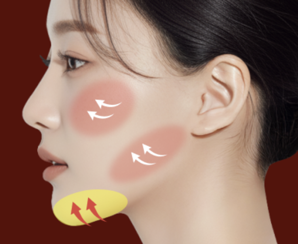 Sinsa Station Lifting Plastic Surgery Clinic Mini Contouring: How to Refine Facial Lines Without Bone Reduction | Liting Plastic Surgery Seoul Branch image 9