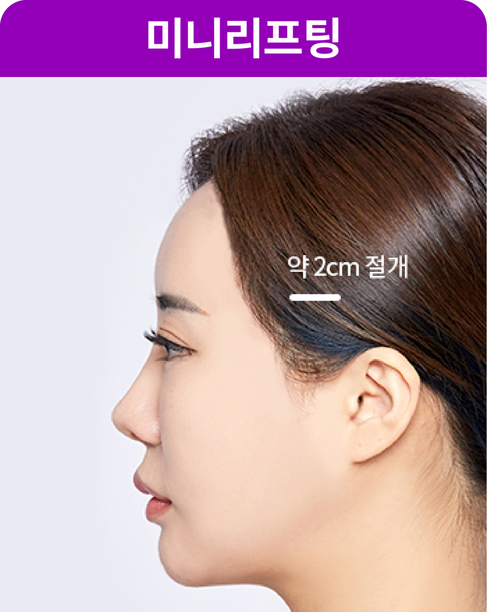 가을 얼굴윤곽 관리, 강남실리프팅으로 자연스럽게 시작 | 처진볼살리프팅 추천 관련 이미지 9