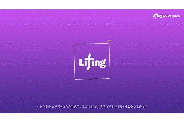 얼굴주름리프팅 실리프팅비용, 여름철에도 걱정 없이 시술 가능한 진짜 이유?! 관련 이미지 1