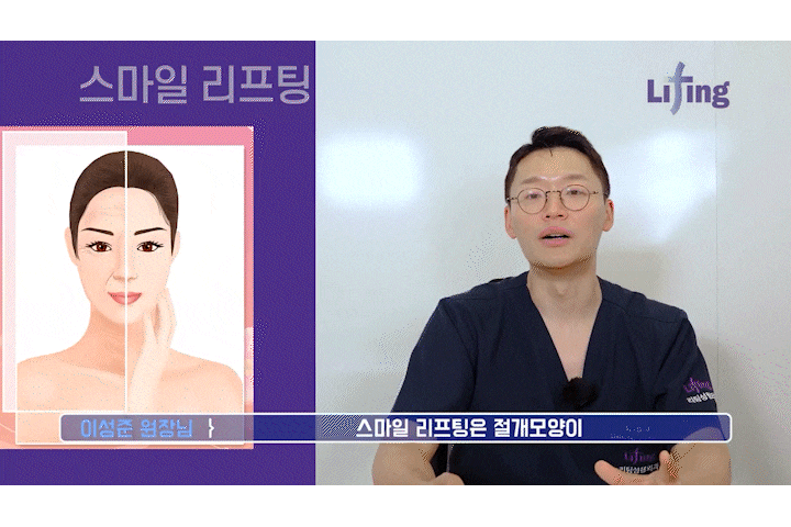 Smile Lift: The Effects and Differences Compared with Mini Lifting, as Seen at a Songpa Plastic Surgery Clinic image 5