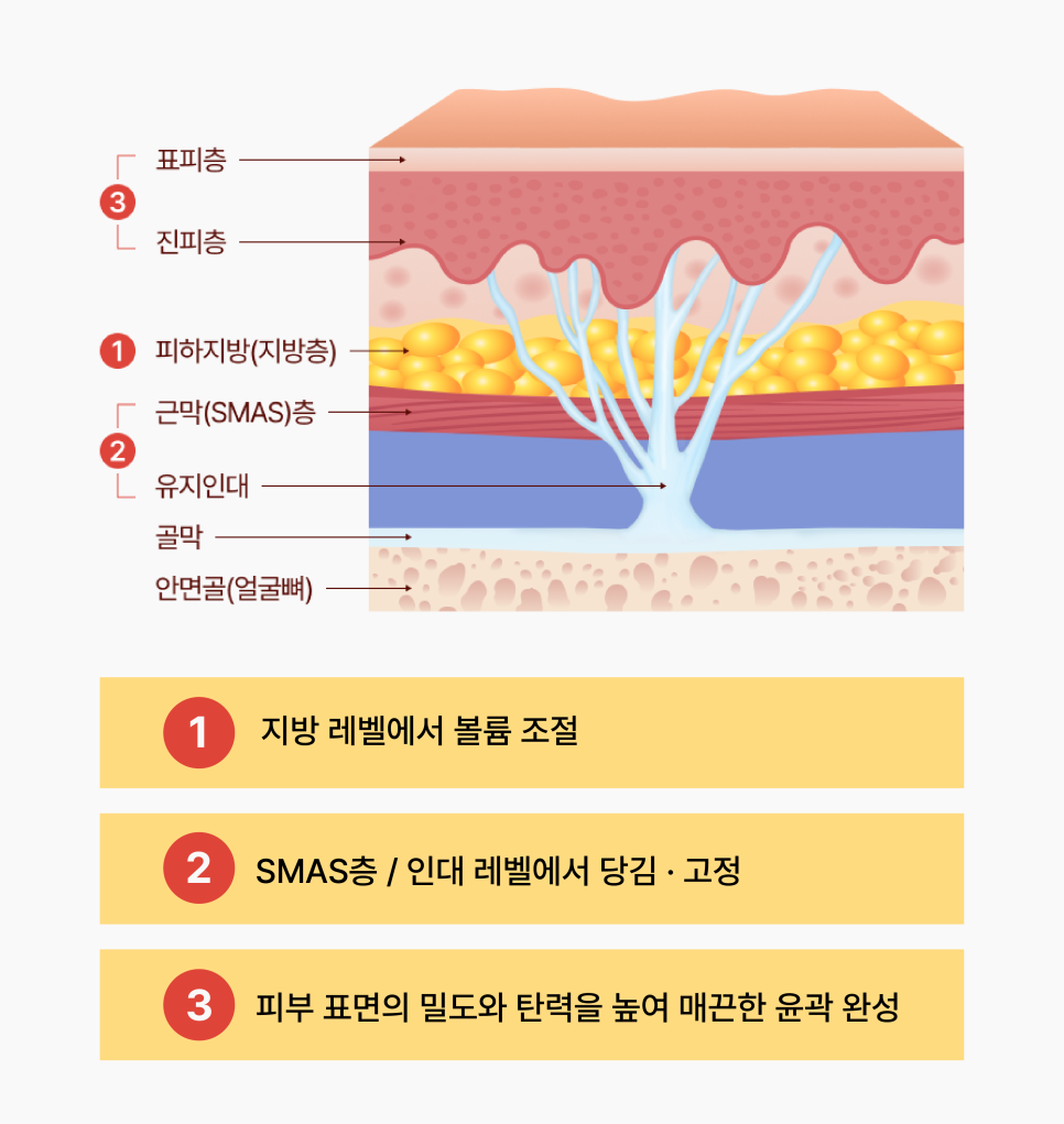 윤곽성형을 고민하게 되는 광대콤플렉스, 원인은 뼈만이 아닙니다 관련 이미지 8