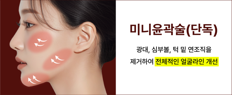 안면윤곽수술 뼈를 깎지 않고 윤곽선을 다듬는 신사윤곽성형외과 관련 이미지 14