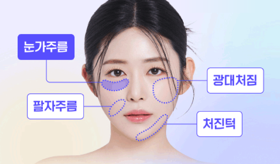 Shinsa Mini Lift, Lifting Plastic Surgery Clinic: Clear Answers to Frequently Asked Questions About Smile Lifting! image 7