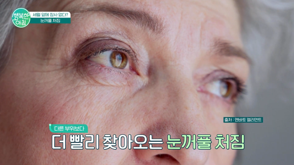 신사리프팅성형외과 눈밑지방재배치수술비용 궁금하다면? 하안검 수술과 비교해보세요 관련 이미지 2
