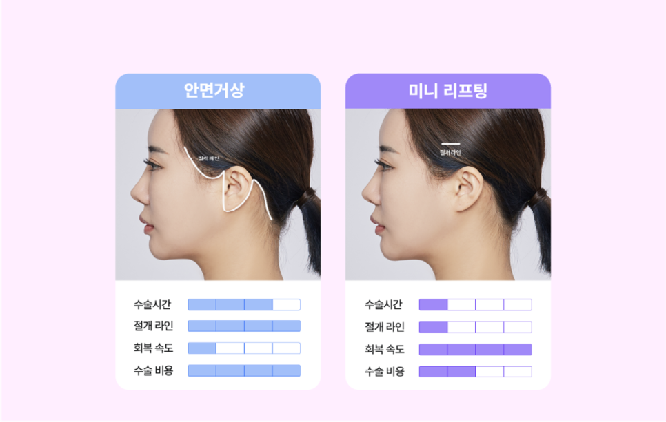 미니리프팅, 여름휴가 전 신사역성형외과에서 알아보는 인상 개선 방법 관련 이미지 4