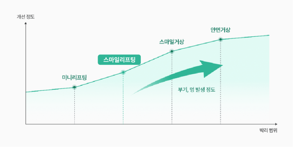 강남미니거상, 왜 안면거상성형외과에서도 주목할까? 관련 이미지 15