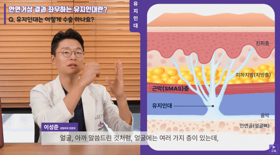 서초성형외과 의료진이 설명하는 안면거상의 모든 것 관련 이미지 5