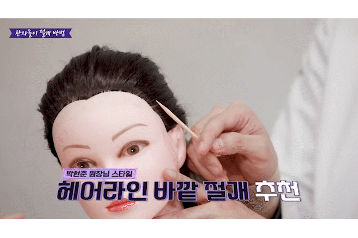 신사역리팅 안면거상술가격 차이, 비용보다 매우 중요한 건 ‘이것?’ 관련 이미지 9