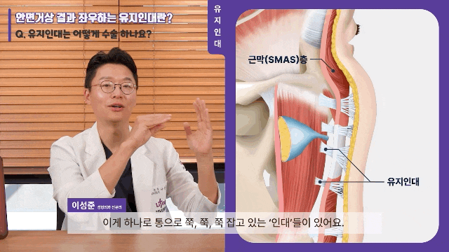 Considering a Facelift in Your 40s? Why Ligament Dissection Is Important at a Gangnam Lifting Clinic image 3