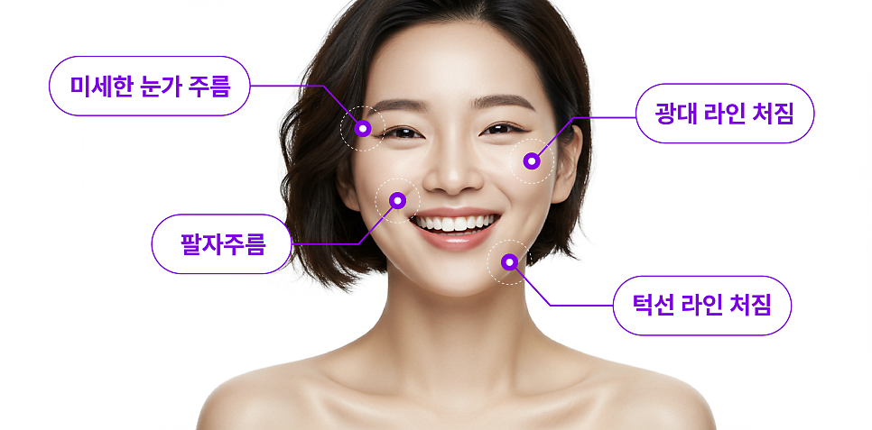 Smiley Lift, How to Improve Midface Sagging While Reducing Incision 부담｜Sinsa Lifting Plastic Surgery Clinic image 9