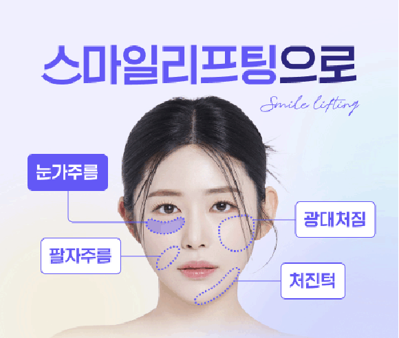 스마일미니리프팅, 압구정리프팅성형외과가 알려주는 인기많은 리프팅 최신 트렌드 관련 이미지 10